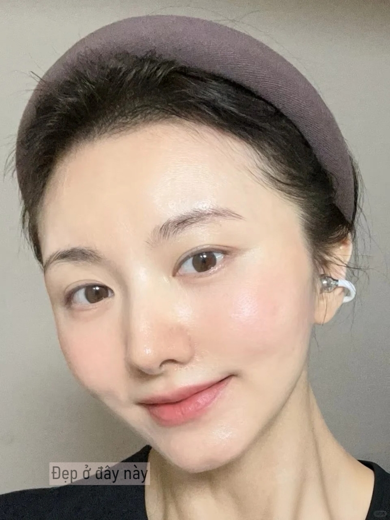 44 tuổi, tôi trị nám thành công nhờ thay đổi 6 thói quen và nhận ra rằng không phải cứ bôi nhiều là tốt- Ảnh 1.