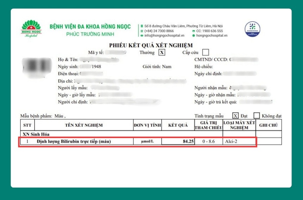 45 phút nội soi lấy trọn sỏi ống mật chủ 1,5cm, hết đau quặn bụng do tắc mật - 1