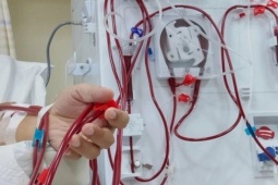 Thực phẩm ngon ngọt nhưng ăn nhiều có thể tăng nguy cơ suy thận, người Việt nên kiểm soát để phòng bệnh