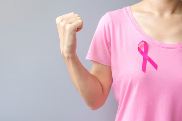 ung thư vú - Ảnh 1.