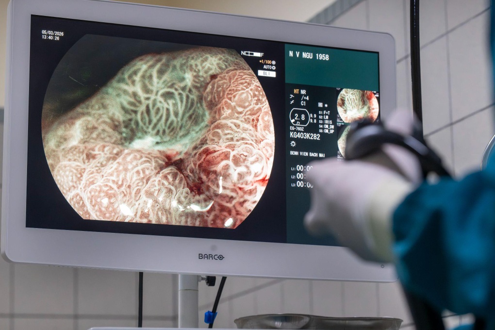 Bác sĩ BV Bạch Mai cảnh báo cách ăn của nhiều người “tiếp tay” cho ung thư - 2