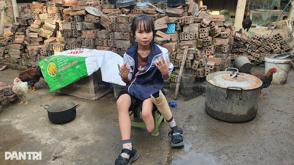 Bé gái cụt chân mồ côi cha, thiếu hơi ấm mẹ, chống chọi bệnh tật, nghèo khó - 1