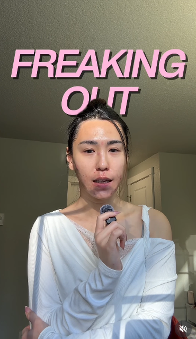 Bị đuổi việc, cô gái 27 tuổi để mặt mộc với mảng mụn lớn lên mạng tâm sự và cái kết bất ngờ- Ảnh 1. Bị đuổi việc, cô gái 27 tuổi để mặt mộc với mảng mụn lớn lên mạng tâm sự và cái kết bất ngờ- Ảnh 1.