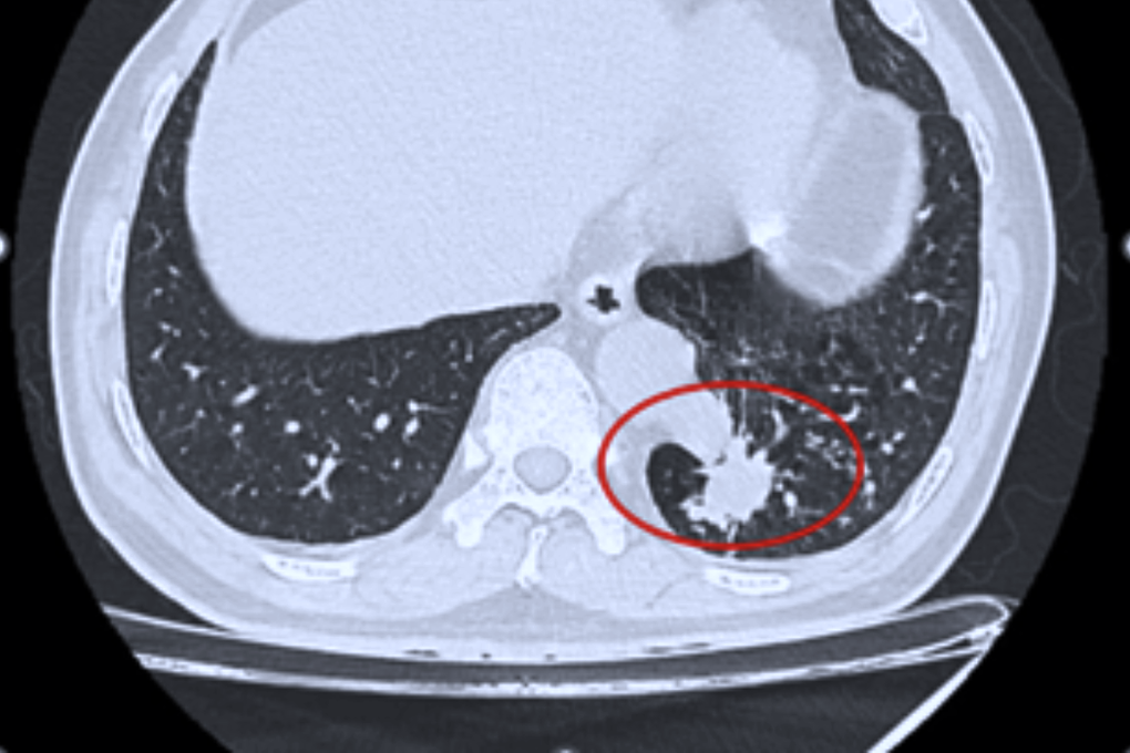 Ca mổ robot chữa bệnh hiếm gặp, lần đầu tiên thực hiện ở Việt Nam - 1