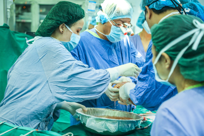 Các bác sĩ ghép gan cho bệnh nhân. Ảnh: Thảo My