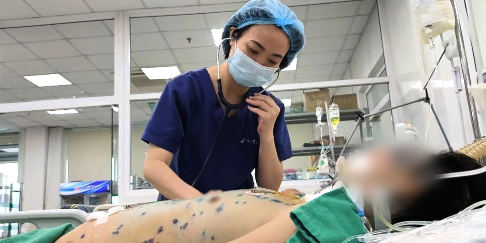 Cẩn trọng thủy đậu gây suy đa tạng, nguy hiểm tính mạng  ở người lớn - Ảnh 1.