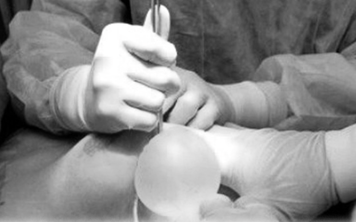 Chân biến dạng sau tiêm filler làm thẳng chân tại nhà - Ảnh 2.