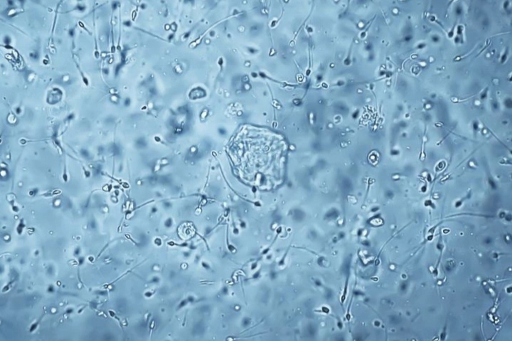 Cơ chế đặc biệt giúp tinh trùng tồn tại nhiều ngày trong cơ thể phụ nữ - 1