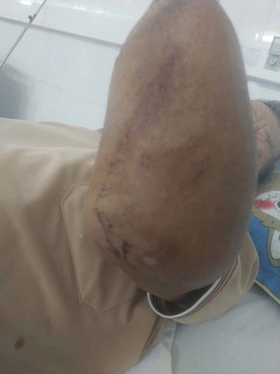 Con trai kể khoảnh khắc cụ ông cụt 2 tay kẹp rắn hổ mang đem về nhà- Ảnh 2.