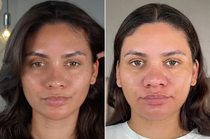 Các đường nét trên gương mặt Amber Pitkin bắt đầu thay đổi khi cô mang bầu. Ảnh: Amber Pitkin