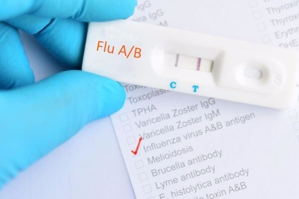 Cúm mùa tưởng nhẹ vẫn có thể gây biến chứng nặng - 1