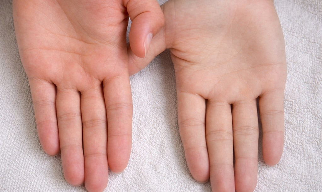 Dấu hiệu cơ thể thiếu sắt 1 Dau hieu co the thieu sat