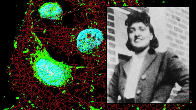 Henrietta Lacks và dòng tế bào bất tử HeLa. Ảnh: IFL Science