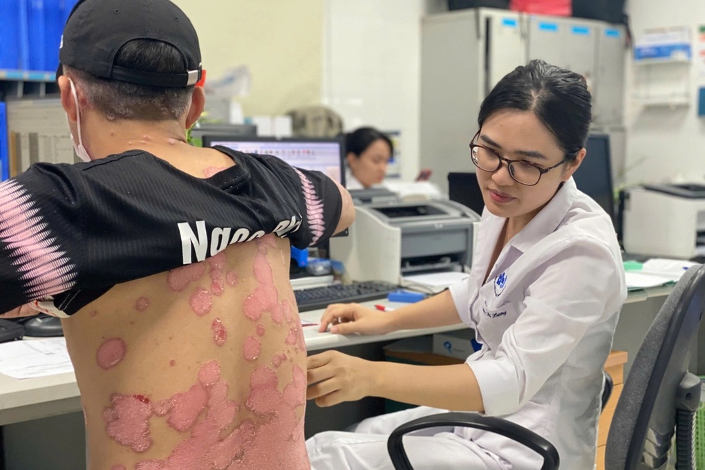 Hai triệu người Việt mắc bệnh vảy nến - 1