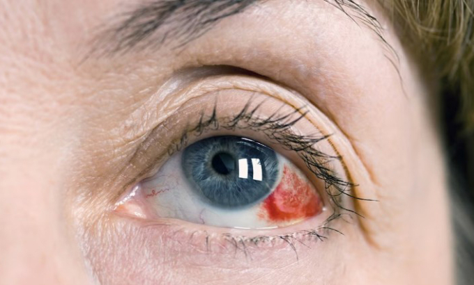 Ảnh minh họa: Medical News Today