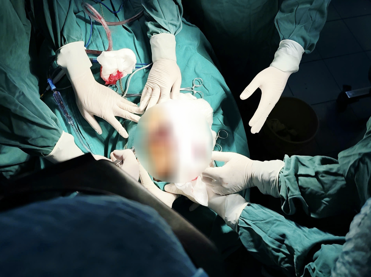 Kéo xe qua vũng lầy, tài xế bị dây xích đứt bắn thẳng vào mặt, xuyên qua hốc mắt - Ảnh 1.