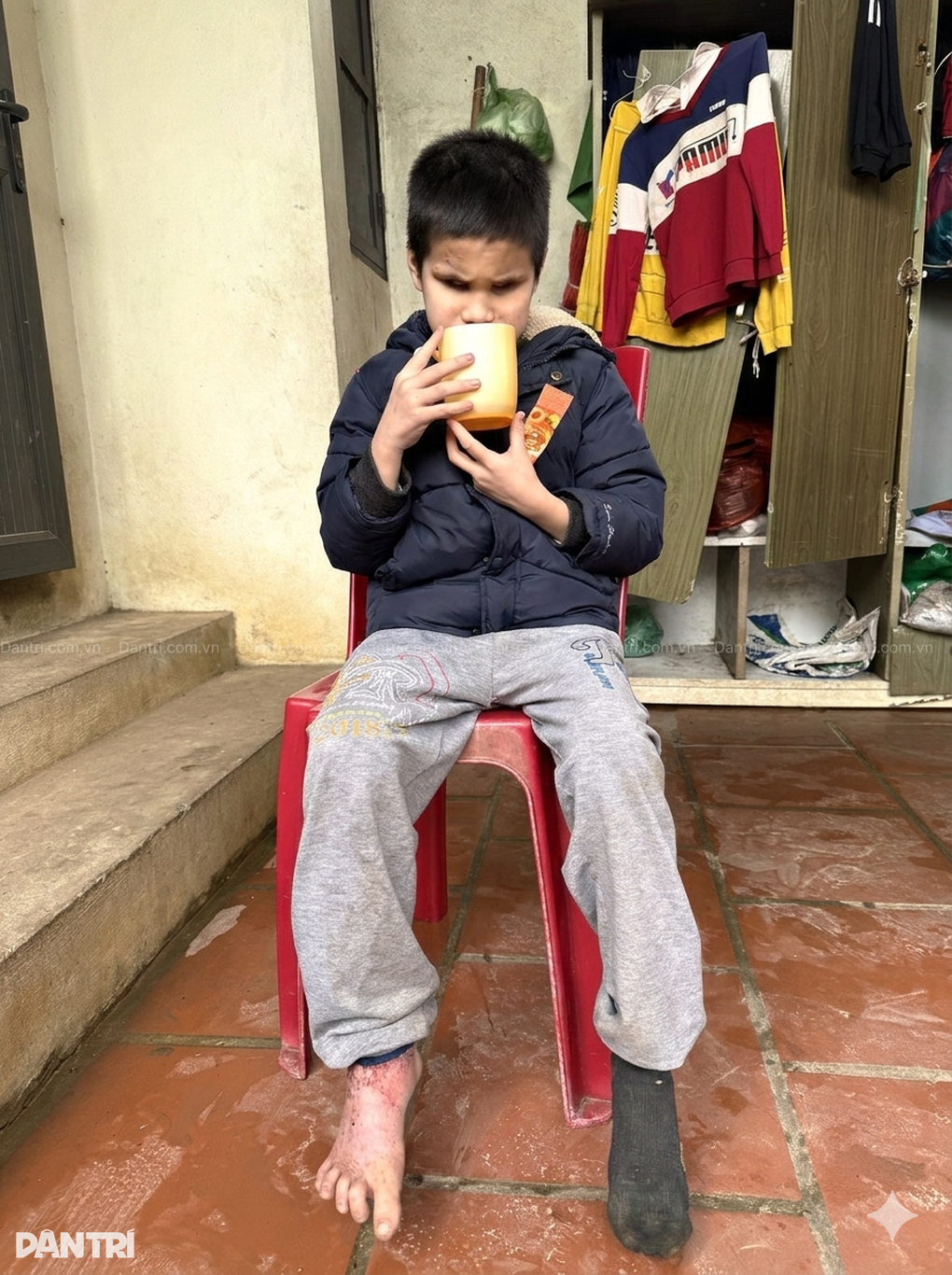 Khó khăn chồng chất khi gia đình có 3 người khiếm thị, thiểu năng trí tuệ - 3