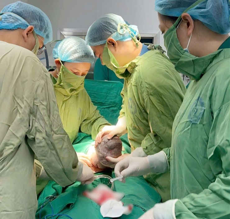 Khoảnh khắc chào đời đặc biệt: Em bé sinh ra với đôi cánh nhỏ trên lưng 1 Khoảnh khắc chào đời đặc biệt của em bé tại Bệnh viện Phụ sản Trung ương. Ảnh: BVCC