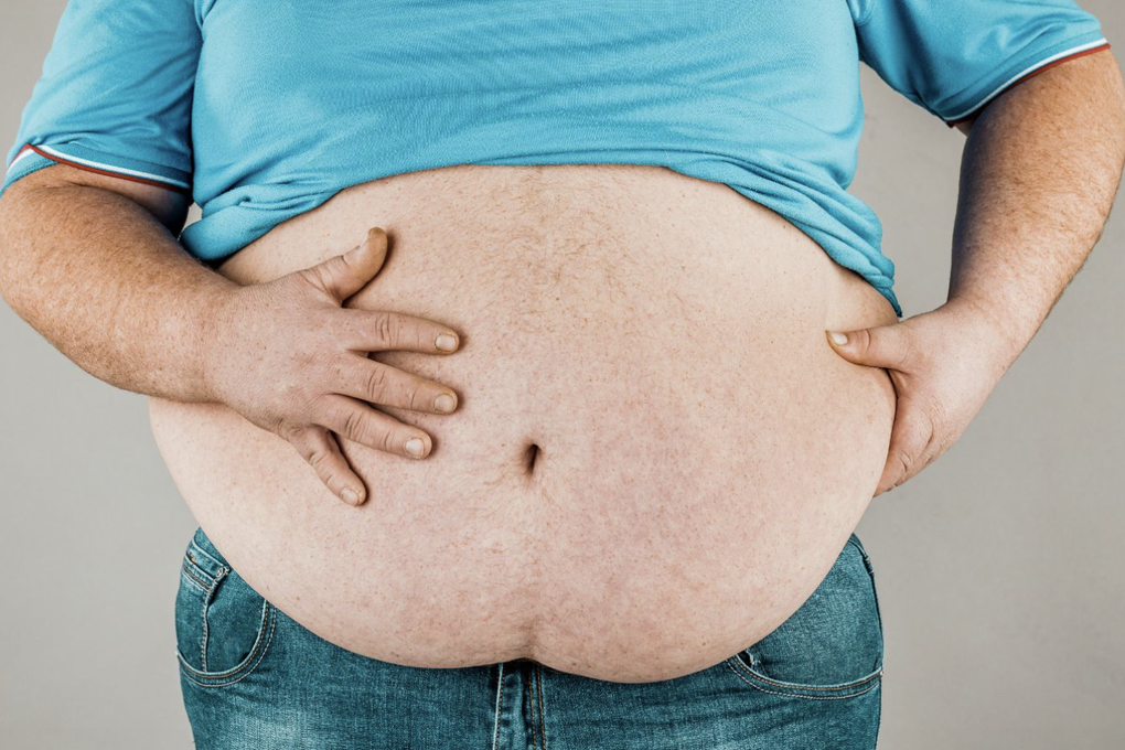 Không thay đổi, người Việt sẽ mất hơn 1,2 tỷ USD để điều trị béo phì - 2