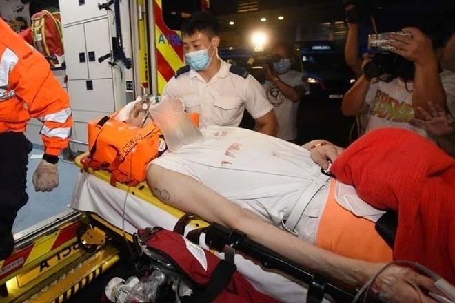 Nam nghệ sĩ bị màn hình LED 600kg rơi trúng lâm vào thảm cảnh tàn tật, bạn gái hủy hôn chia tay- Ảnh 2.