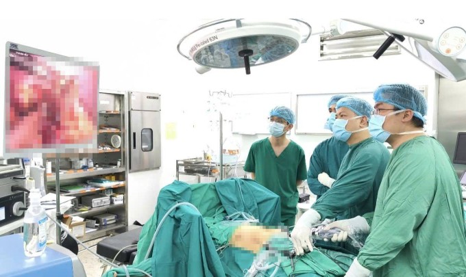 Bệnh nhân được tiến hành phẫu thuật nội soi cắt gan trái để ngừa tổn thương, biến chứng. Ảnh: Bệnh viện cung cấp