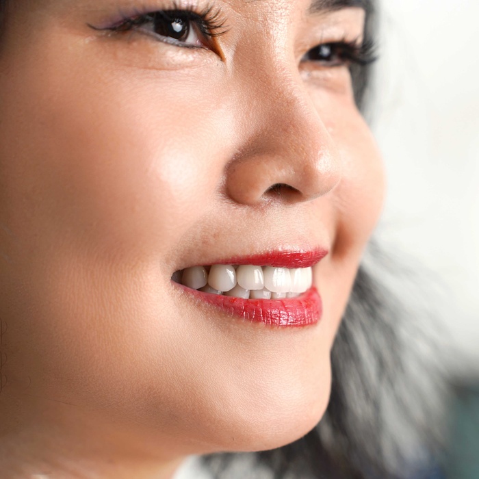 Showcase: Những màn lột xác nụ cười từ triết lý Xâm lấn tối thiểu – Độ bền tối đa tại Nha khoa Nhân Tâm