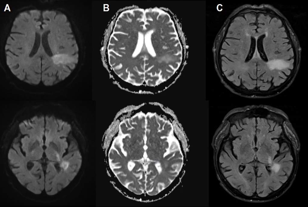 Rất có thể bạn đã bị nhiễm một loại virus ăn não mà bạn chưa từng nghe đến- Ảnh 2. Rất có thể bạn đã bị nhiễm một loại virus ăn não mà bạn chưa từng nghe đến- Ảnh 2.