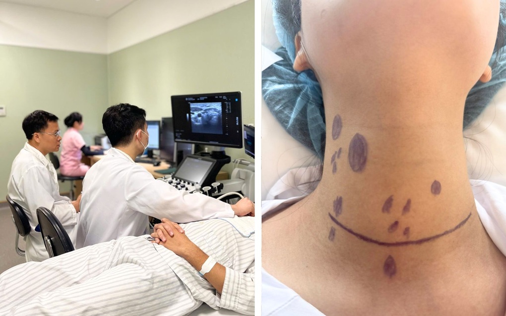 Sờ thấy khối cứng ở cổ, cô gái 24 tuổi phát hiện ung thư đã di căn hơn 20 hạch - 1