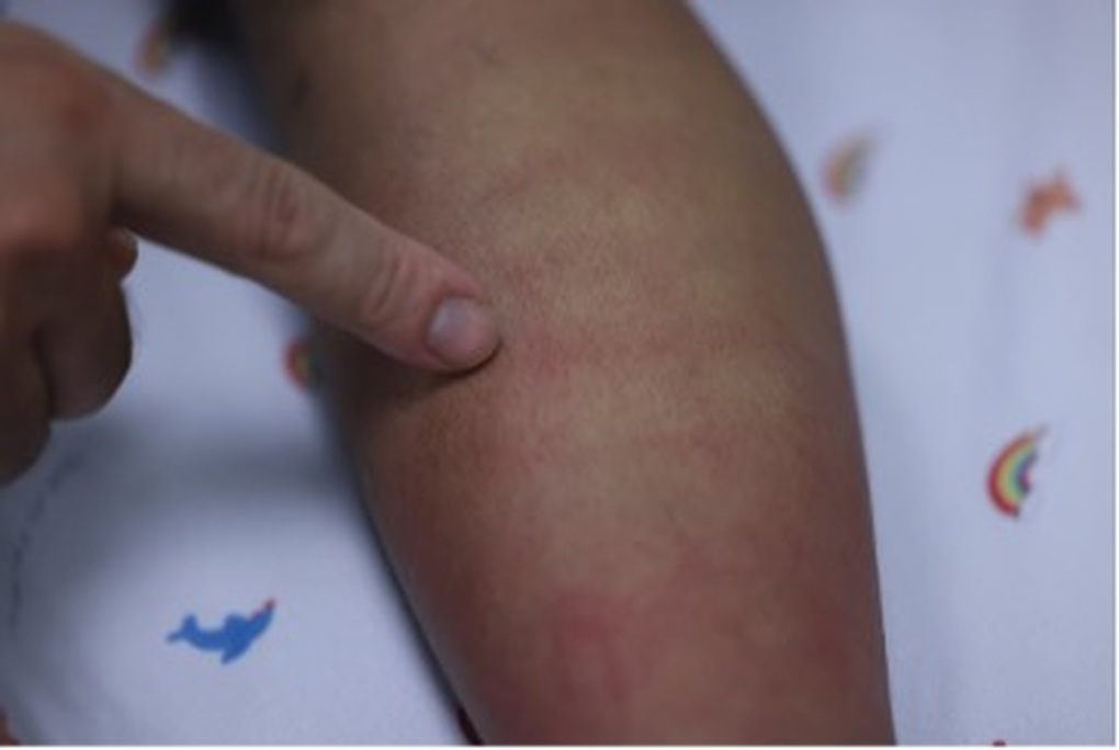 Sốt xuất huyết Dengue và những dự định dở dang bên giường bệnh - 2