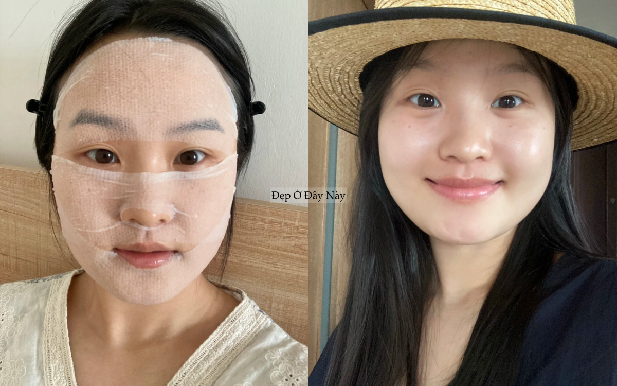 Tạm biệt da dầu bóng nhẫy, cô nàng này tìm ra cách khiến da ráo mịn và ngừa lão hóa- Ảnh 1.