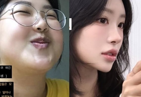 Con gái Choi Jil Sil có đang hành hạ bản thân: Thân hình da bọc xương, nghiện thẩm mỹ, khao khát 1 thứ giống Jennie- Ảnh 3.