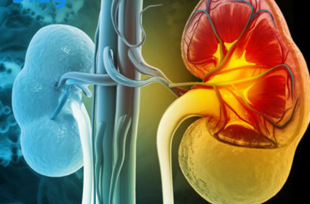 Thực phẩm ngon ngọt nhưng ăn nhiều có thể tăng nguy cơ suy thận, người Việt nên kiểm soát để phòng bệnh 3 Ảnh minh họa.