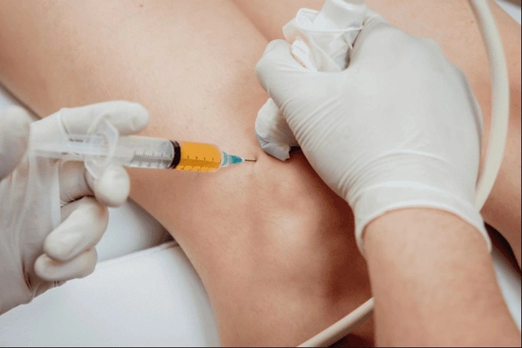 Tình trạng nguy hiểm dễ gặp ở khớp gối bệnh nhân gout - 1