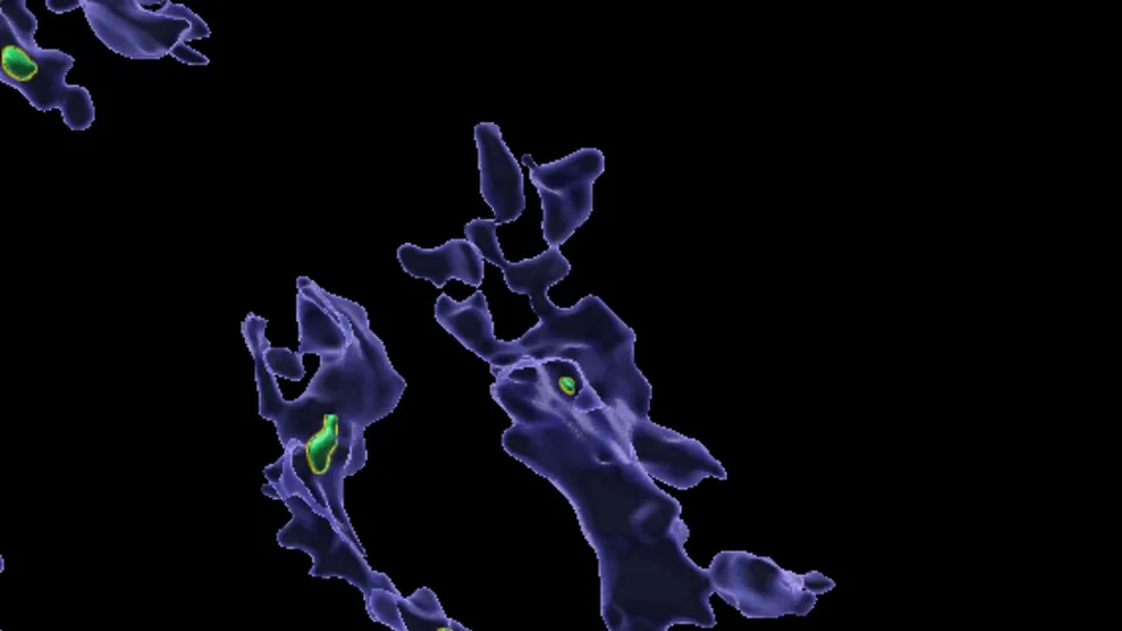 Vi nhựa tích tụ trong cơ thể có thể làm tắc nghẽn các tế bào miễn dịch - 1