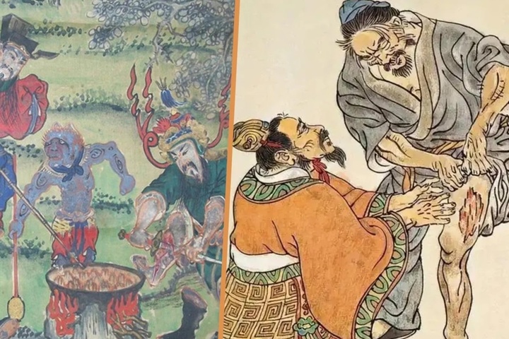 Vì sao Trung Quốc cổ đại thịnh hành việc tự cắt thịt chữa bệnh cho cha mẹ?- Ảnh 1.
