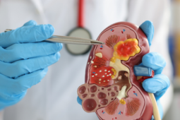 Loại rau ngon bổ nhưng tăng gánh nặng cho thận, người bệnh suy thận cần biết để tránh