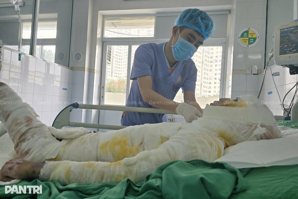 Vợ bán nương, khẩn cầu cứu chồng bỏng 66% cơ thể, có 95% cơ hội sống - 1