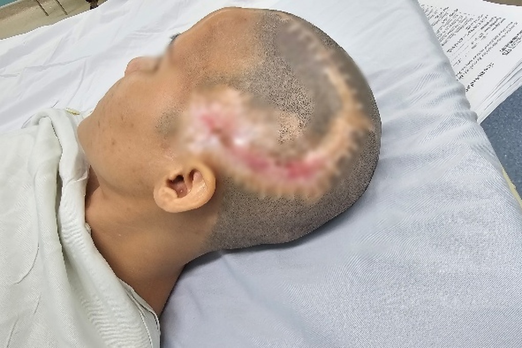 TPHCM: Cô gái đột qụy, biến dạng vùng đầu nặng nề sau phẫu thuật thẩm mỹ - 2