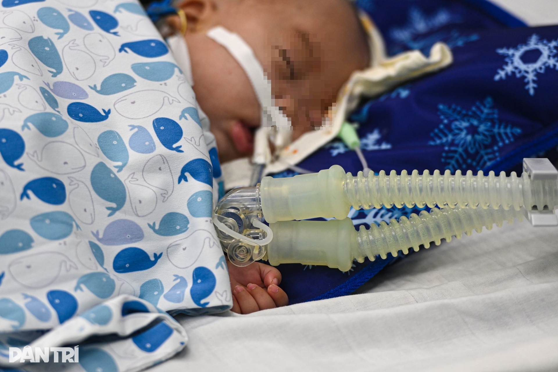 Hà Nội: Chỉ vài ngày ho sốt, nhiều trẻ đã viêm phổi nặng vì RSV - 13