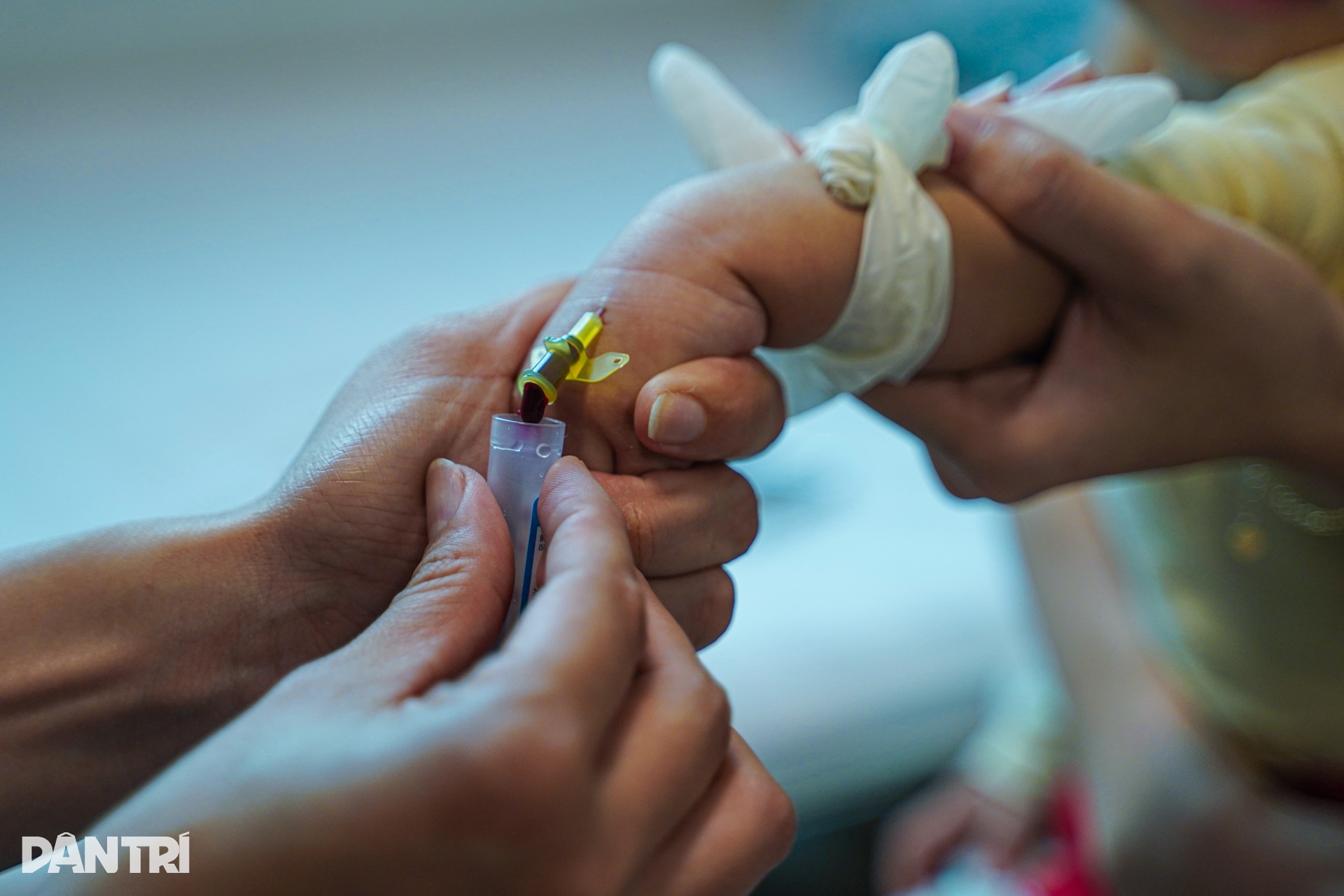 Hà Nội: Chỉ vài ngày ho sốt, nhiều trẻ đã viêm phổi nặng vì RSV - 16