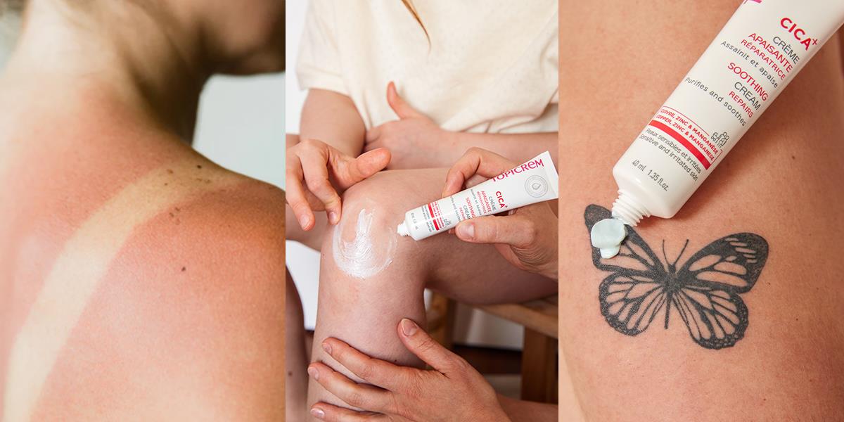 Sống nhanh, da cũng “đuối”: Đâu là giải pháp phục hồi cho làn da thương tổn?- Ảnh 2.