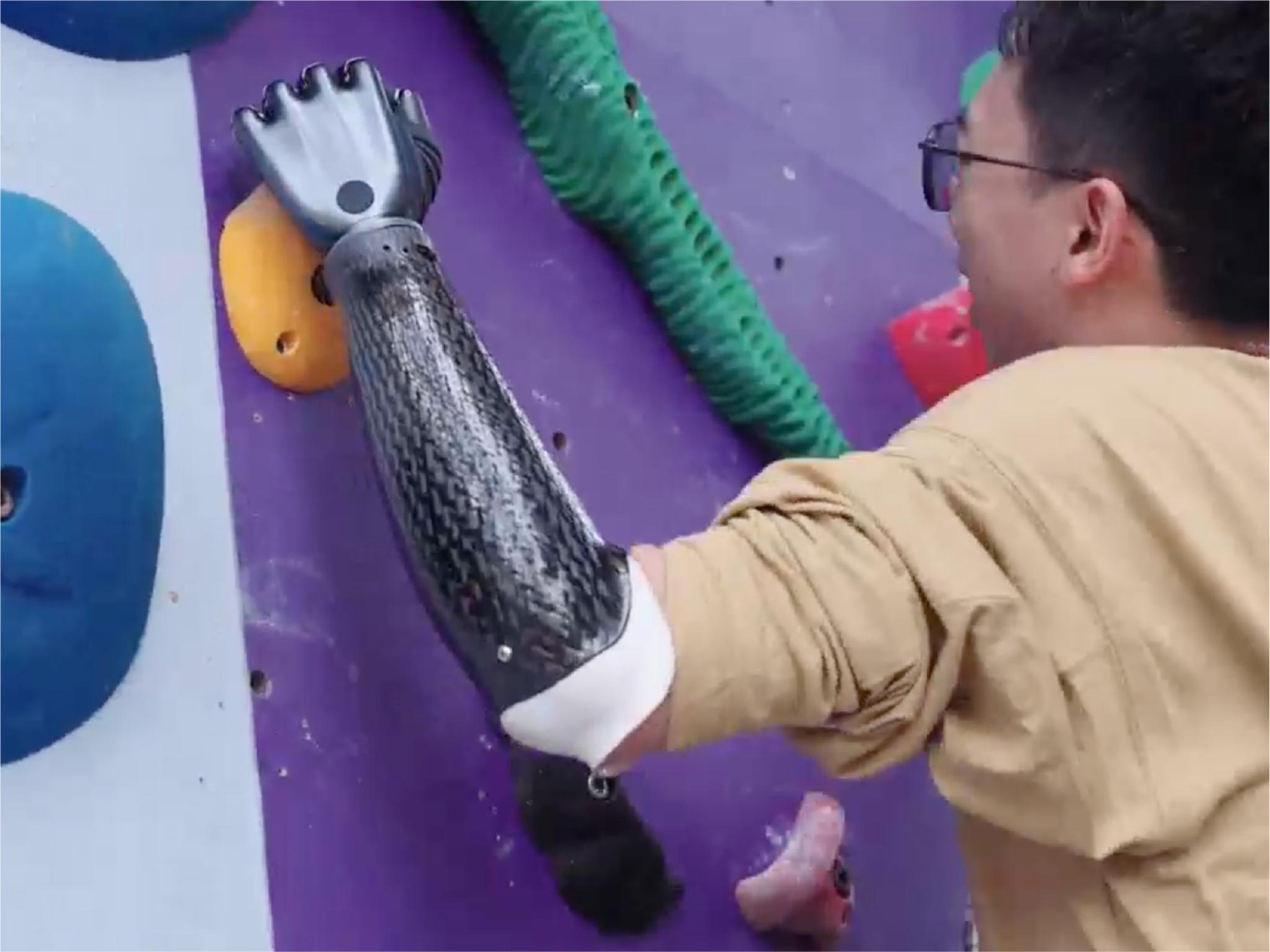 Trung Quốc lại một lần nữa khiến cả thế giới bất ngờ với cánh tay giả có thể 