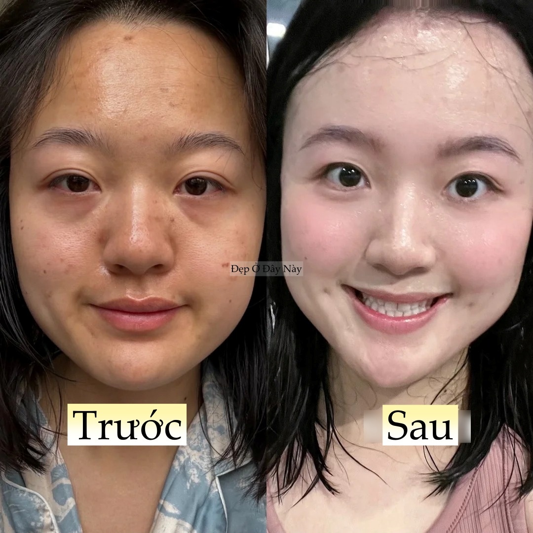 Làm 5 việc này khi đi ngủ, làn da của tôi như 