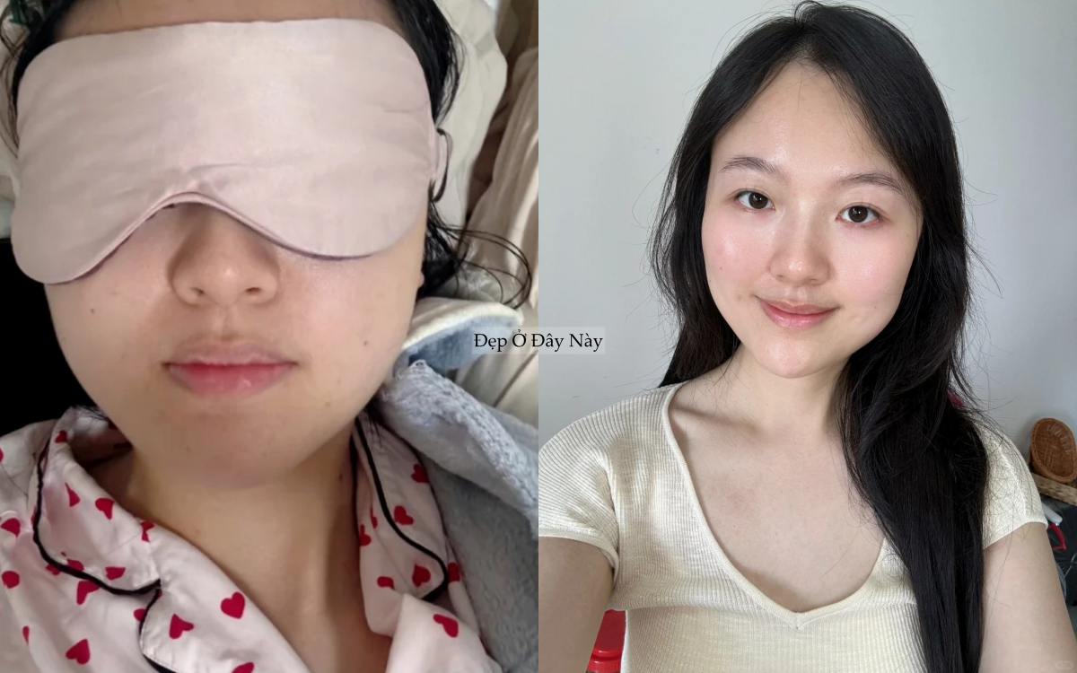 Làm 5 việc này khi đi ngủ, làn da của tôi như 