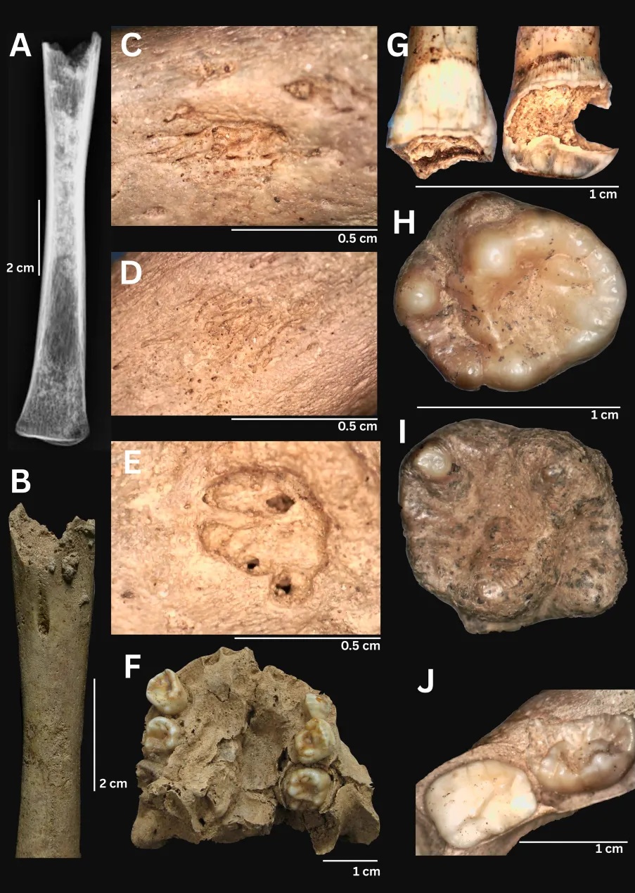 Nghiên cứu quốc tế hé lộ bất ngờ về hài cốt 4.000 năm ở Việt Nam 2 Nghiên cứu quốc tế hé lộ bất ngờ về hài cốt 4.000 năm ở Việt Nam - Ảnh 2.