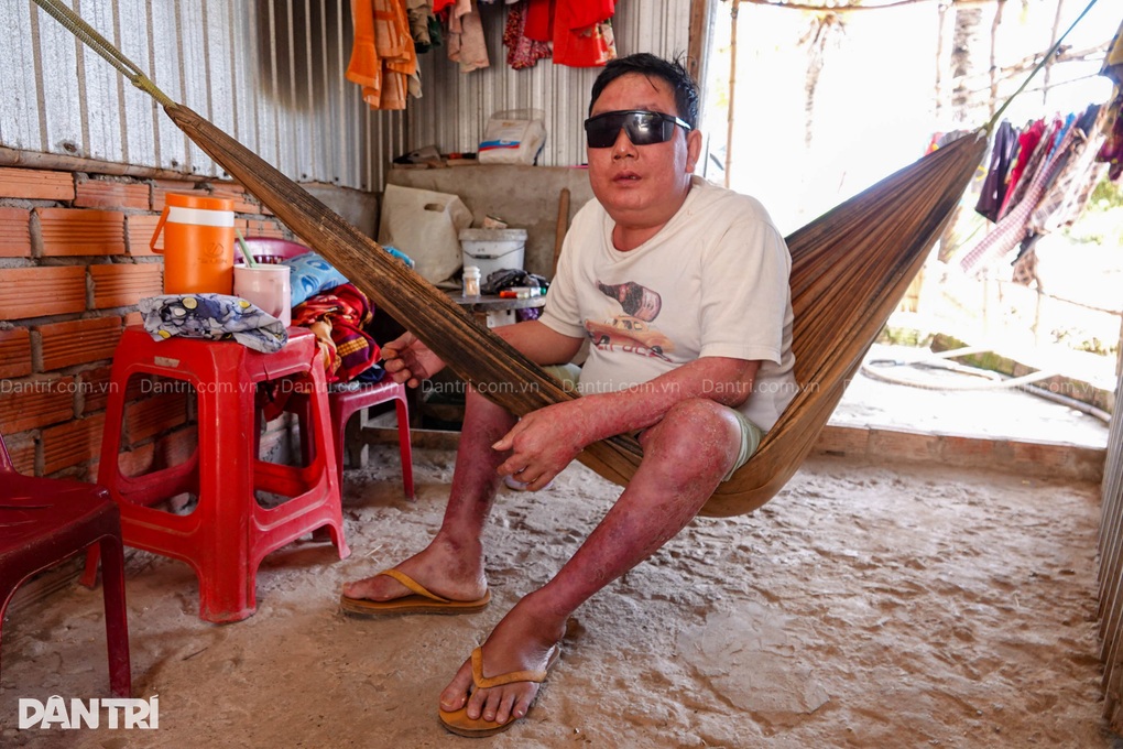 Trụ cột gia đình đổ bệnh hiểm nghèo, vợ làm cỏ mướn nuôi 3 con thơ - 2