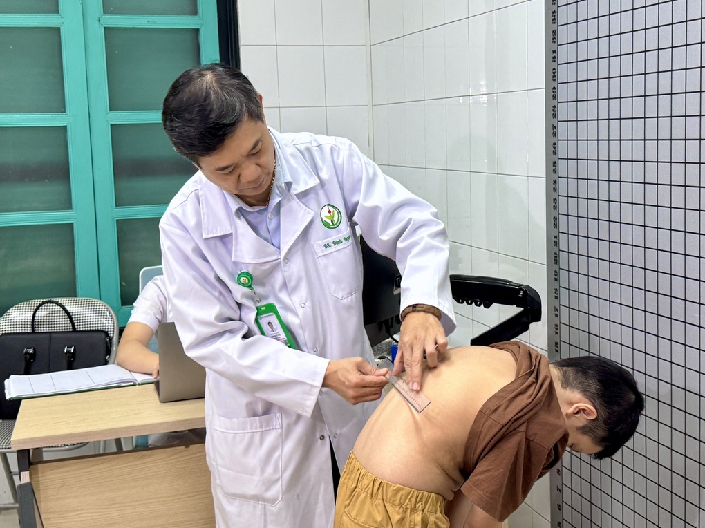 Nghĩ lệch vai nhẹ, nhiều trẻ vẹo cột sống nặng: Bác sĩ chỉ cách phát hiện - 3