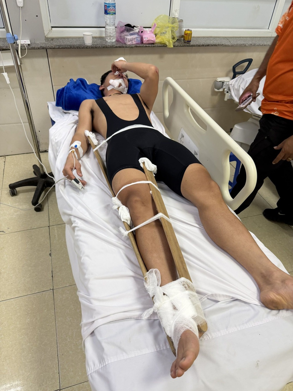 Tranh cãi VĐV đua xe đạp bị đối thủ chơi xấu, gãy chân ở vạch đích - 3