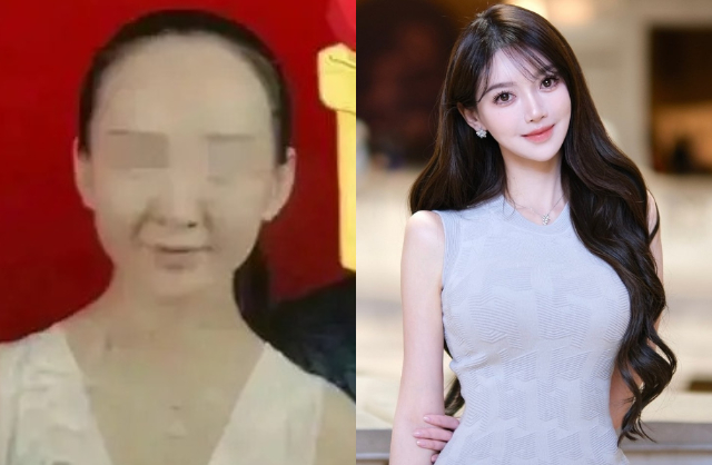 Hoa khôi sinh con cho Huỳnh Hiểu Minh “dao kéo” 100% cơ thể, xem diện mạo trước chỉnh sửa mà sốc nặng- Ảnh 4.