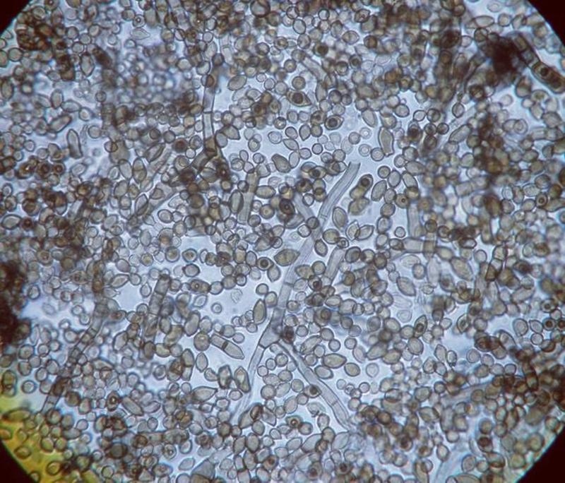 Một sinh vật đột biến đã được phát hiện ở Chernobyl, sở hữu những khả năng đặc biệt, bao gồm khả năng ăn bức xạ hạt nhân 4 1775897087 396 Mot sinh vat dot bien da duoc phat hien o